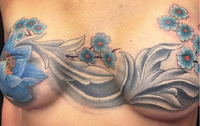 Portland Tattoo Artist Helps Breast Cancer Survivors Find 'New