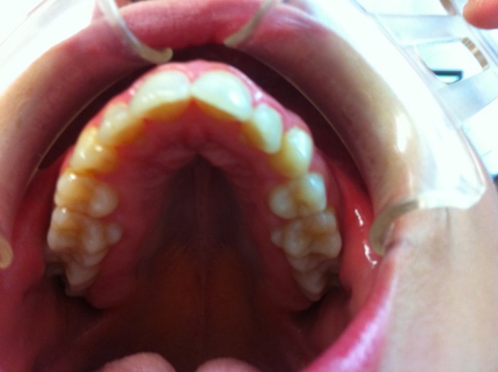 dentist Thairah Shaker teeth open mouth
