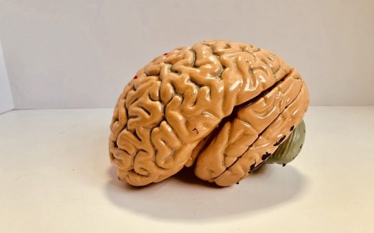 Alzheimer's