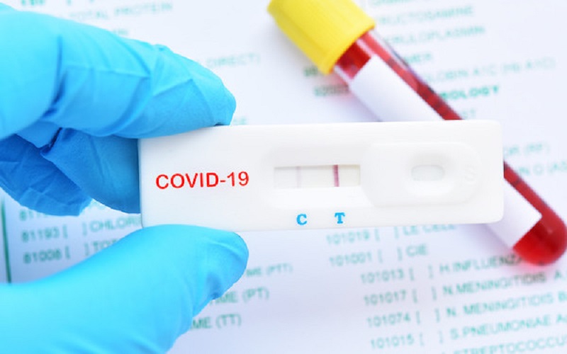 coronavirus test picture