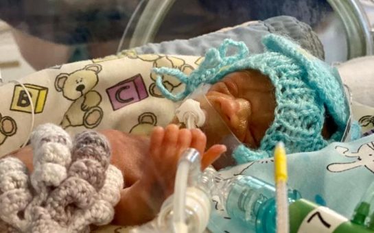 Logan was born extremely prematurely, weighing just 600g