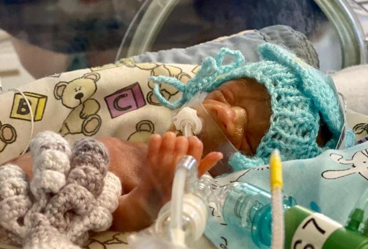 Logan was born extremely prematurely, weighing just 600g